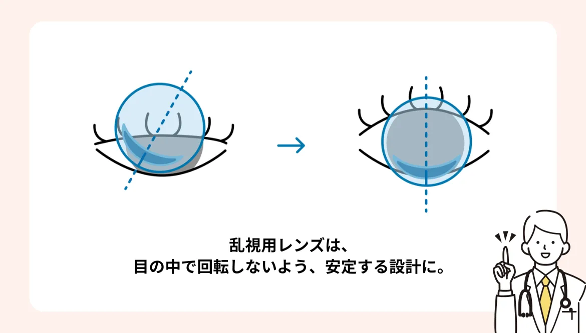 乱視用コンタクトレンズとは？簡易診断つき！快適な乱視用レンズの